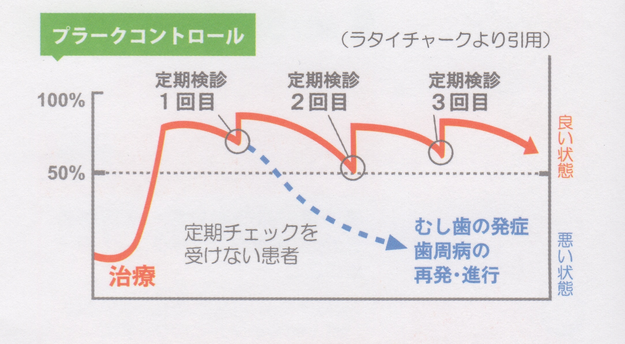 定期的なプラーク除去で予防を