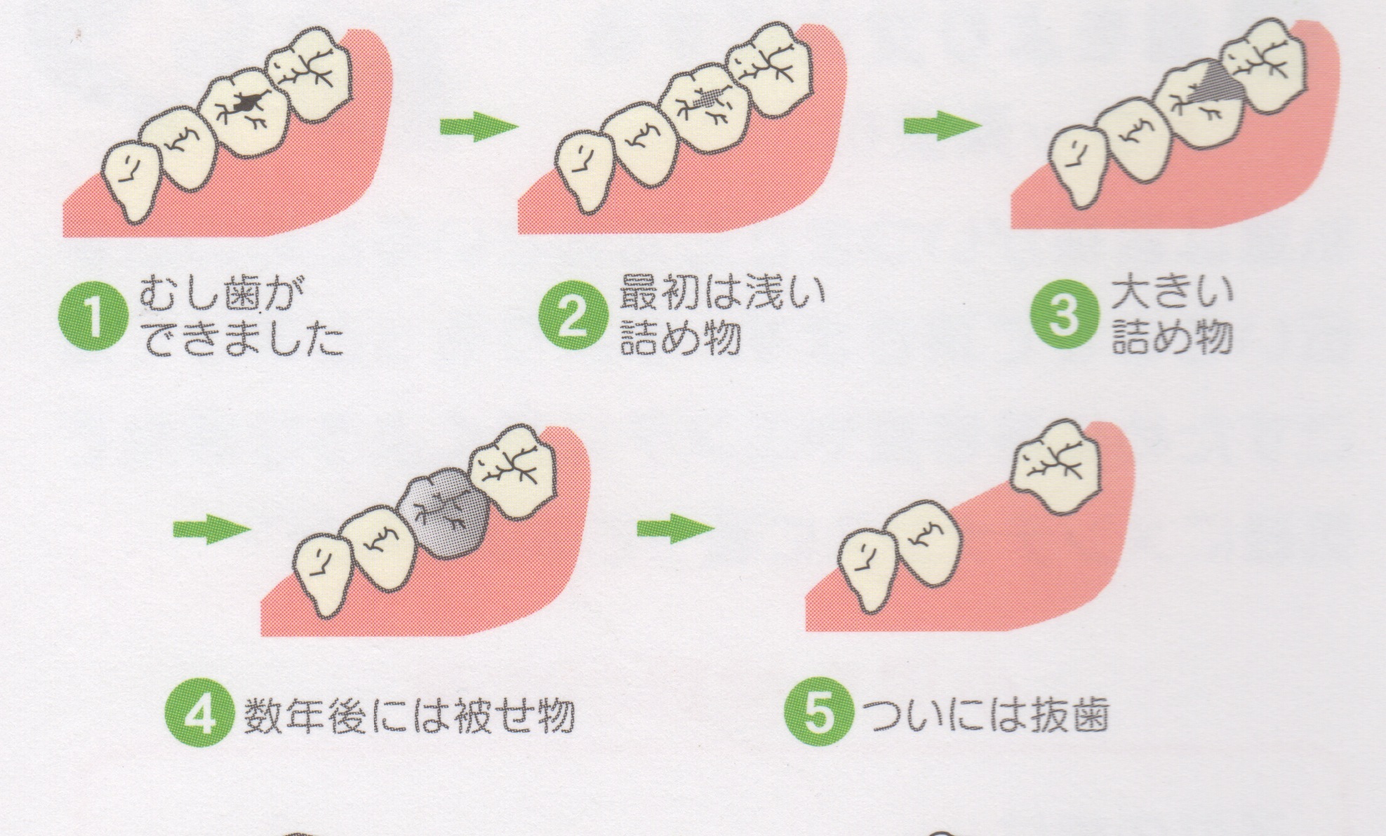 『悪くなったら歯医者さんへ行く』はもう古い！？