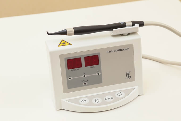 虫歯検知器DIAGNOdentによるチェック
