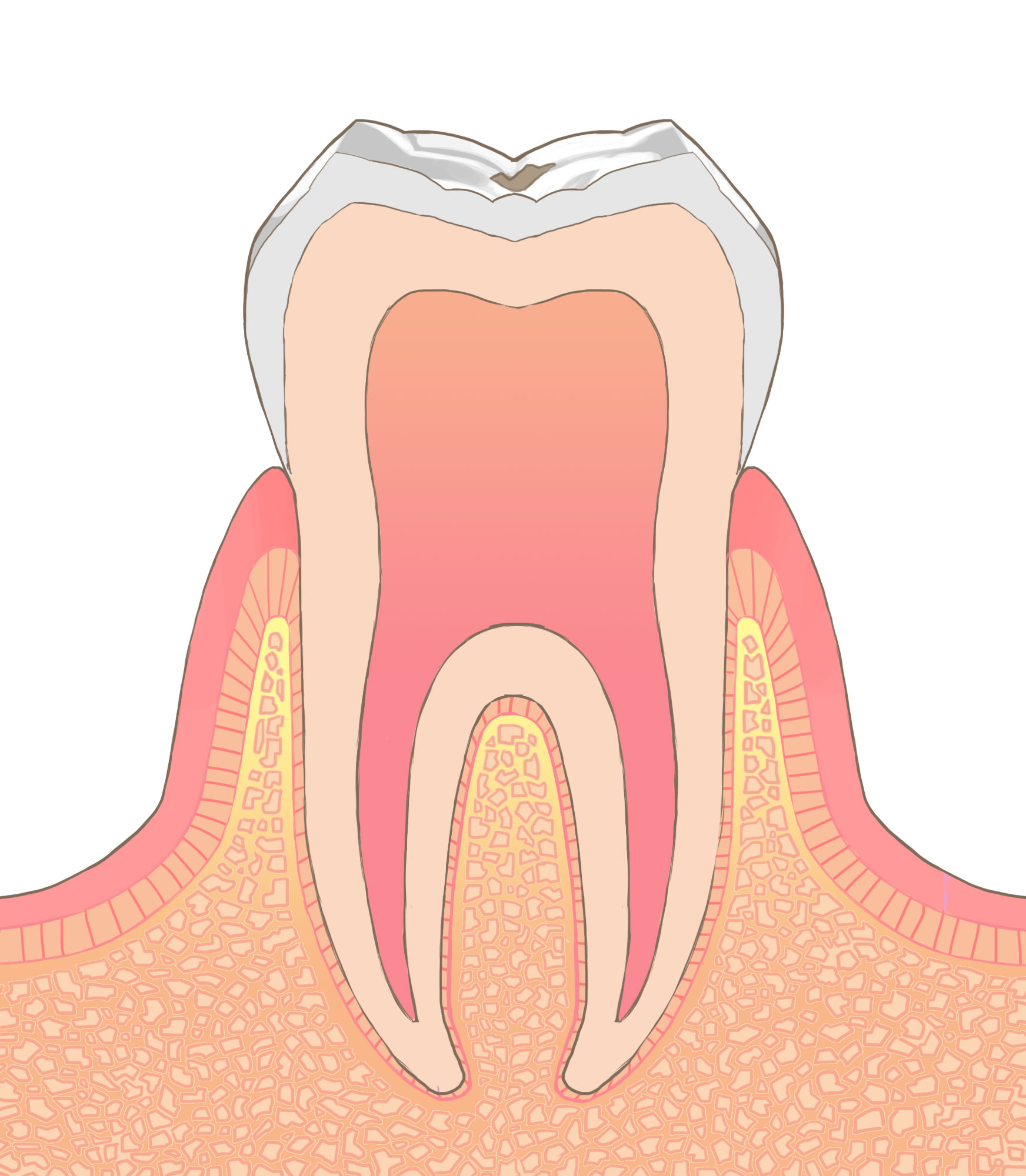 歯の図