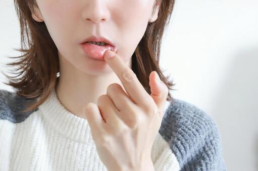 口内炎