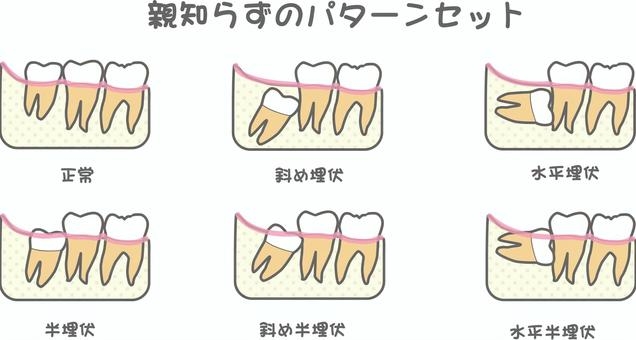 親知らず