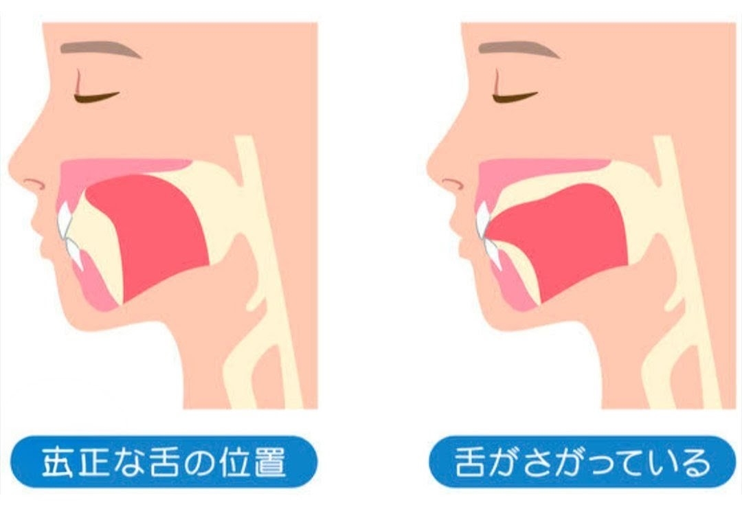 竹内