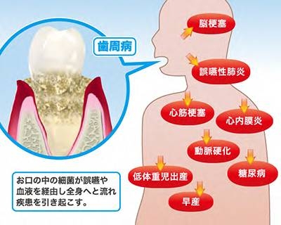 竹内