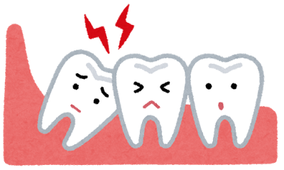 親知らずの抜歯