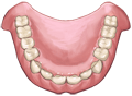 入れ歯１