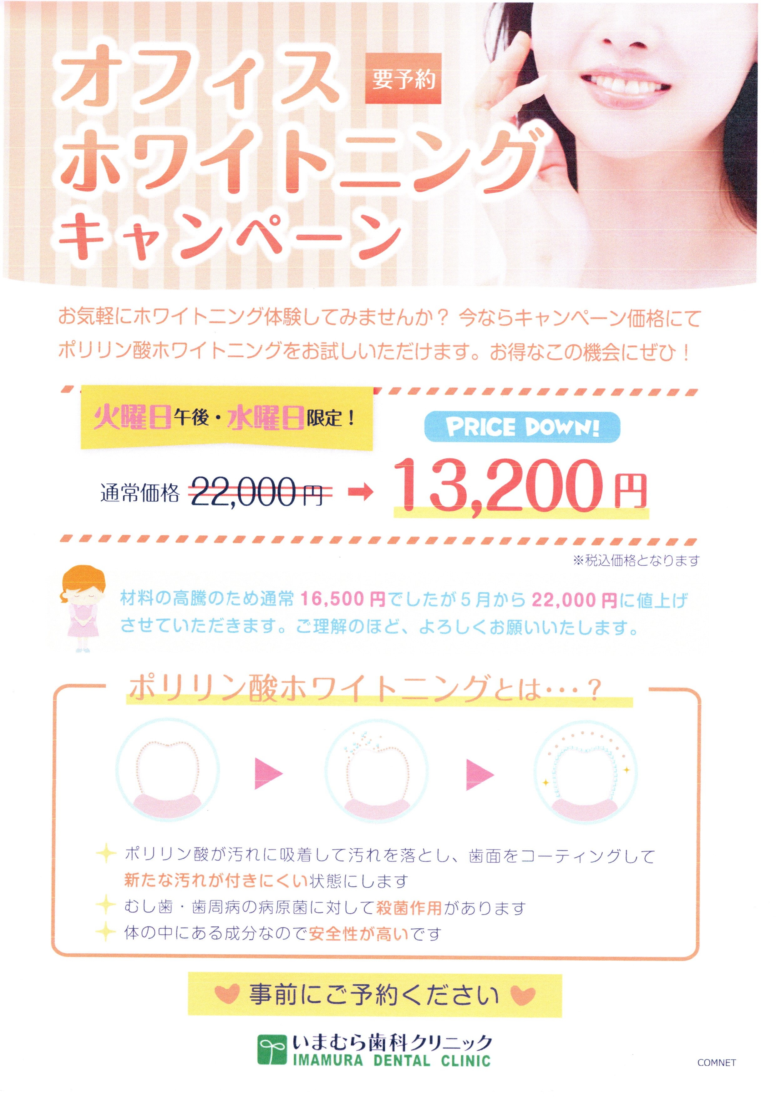 ホワイトニング